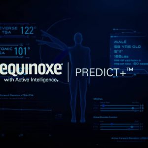 Exactech Equinoxe with Active Intelligence Predict+