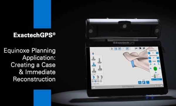 Equinoxe Planning Application Creating a Case Immediate Reconstruction