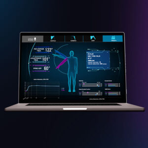 Exactech Predict+