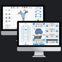 Exactech Active Intelligence