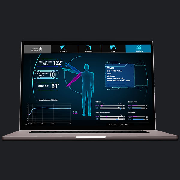 Exactech Predict+