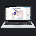 Exactech Active Intelligence Shoulder GPS Planning