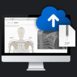 Exactech Active Intelligence