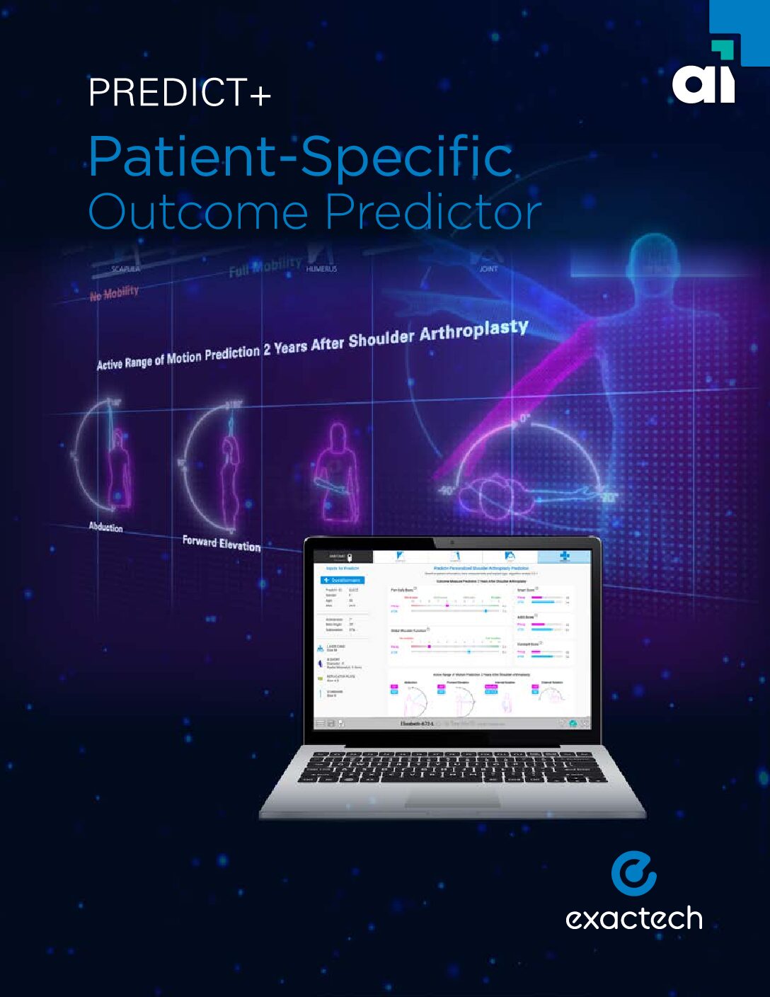 Exactech Predict+ Product Sheet