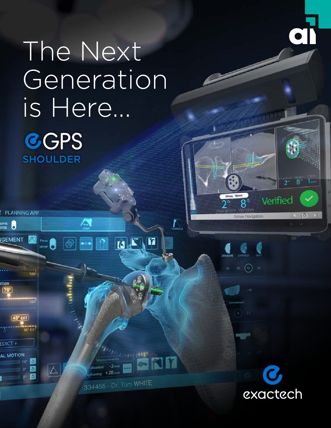 Exactech ExactechGPS Shoulder Application Product Sheet