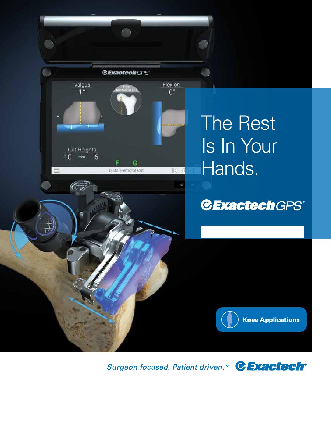 Exactech GPS Knee Applications Product Sheet - 712-26-13 Rev C